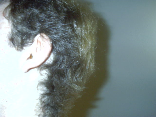 Kewn's actual ear!!!!
