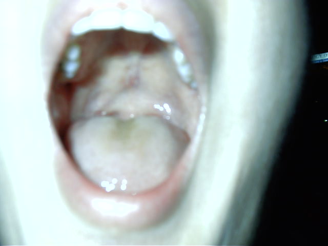 KS checks for tonsils.