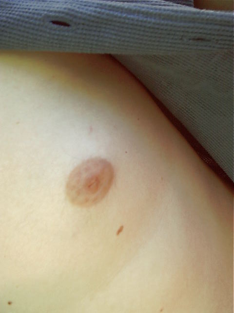Fatcat's nipple