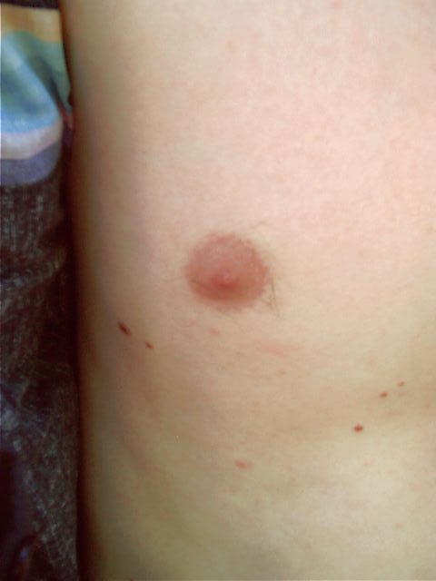 My nipple