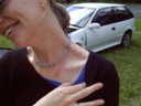Megan shows off her wounds