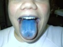 Braggy has been licking too many smurfs.