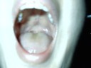 KS checks for tonsils.