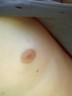 Fatcat's nipple