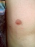 My nipple